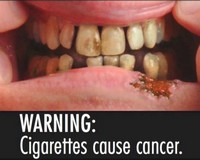 Malta is one of nine EU countries to use pictorial warnings
