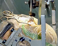 Groundbreaking Deep Brain Stimulation Services in Mata