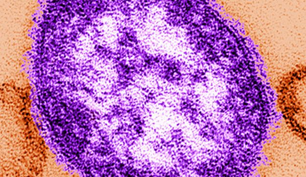Malta within ECDC elimination target for measles and rubella Malta within ECDC elimination target for measles and rubella