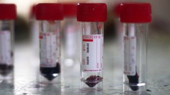 New avian influenza’s rapid spread to Europe threatens poultry sector – FAO and OIE New avian influenza’s rapid spread to Europe threatens poultry sector – FAO and OIE