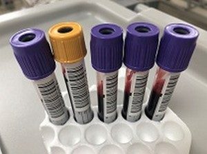 Phlebotomy service now available in the home for elderly and those with disability