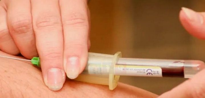 Malta’s first case of Monkeypox detected in 33-year old man