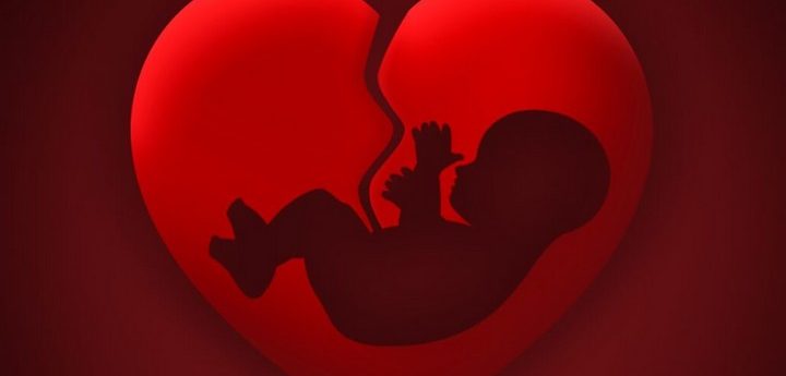 70% oppose abortion if mother’s life not at risk – Church survey