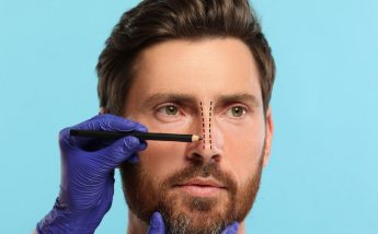 BOV offers personal loans for medical or cosmetic procedures BOV offers personal loans for medical or cosmetic procedures